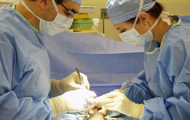 Bir Üyeyi Artırmak İçin Operasyon