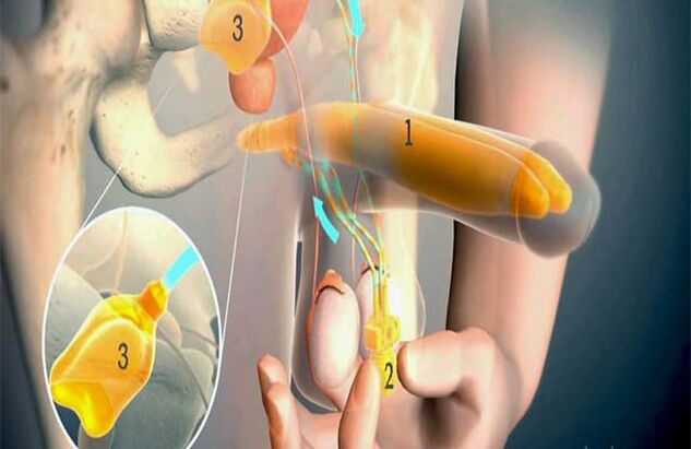 Lipofilling işlemi