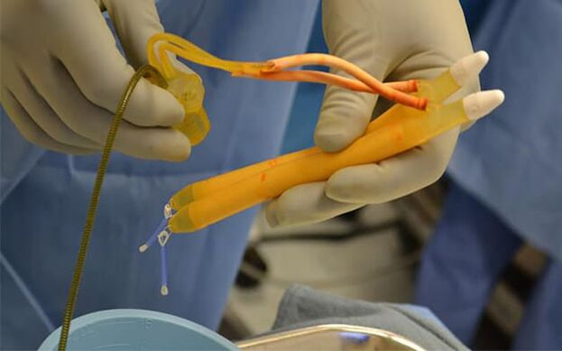Penisdeki implantlar